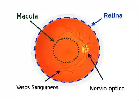 Examen de fondo de ojo mostrando la retina y el nervio óptico con gran detalle.