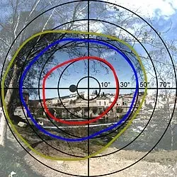 Paciente realizando un estudio de campo visual computarizado en un campímetro.