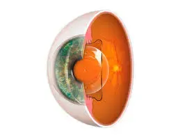 Esquema de un lente fáquico (ICL) posicionado dentro del ojo