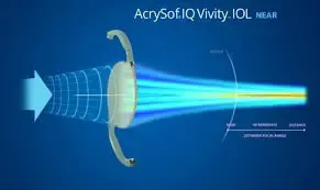 Diagrama del lente intraocular Vivity mostrando su tecnología de rango extendido
