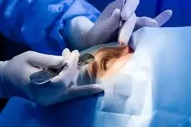 Imagen de un equipo de Tomografía de Coherencia Óptica (OCT) evaluando un nervio óptico