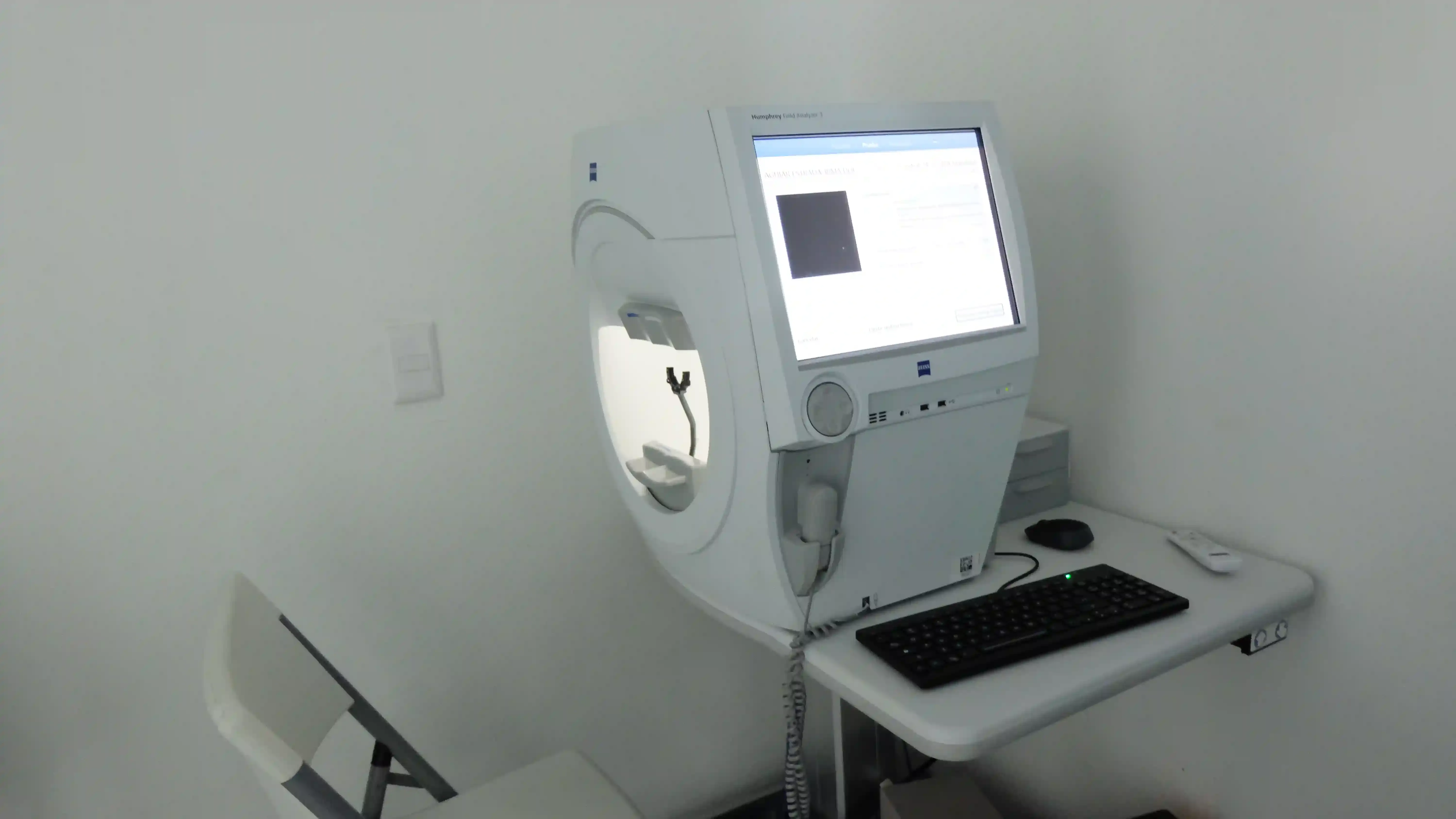 Imagen de una topografía corneal, con colores que indican la curvatura y el adelgazamiento de la córnea característicos del queratocono.